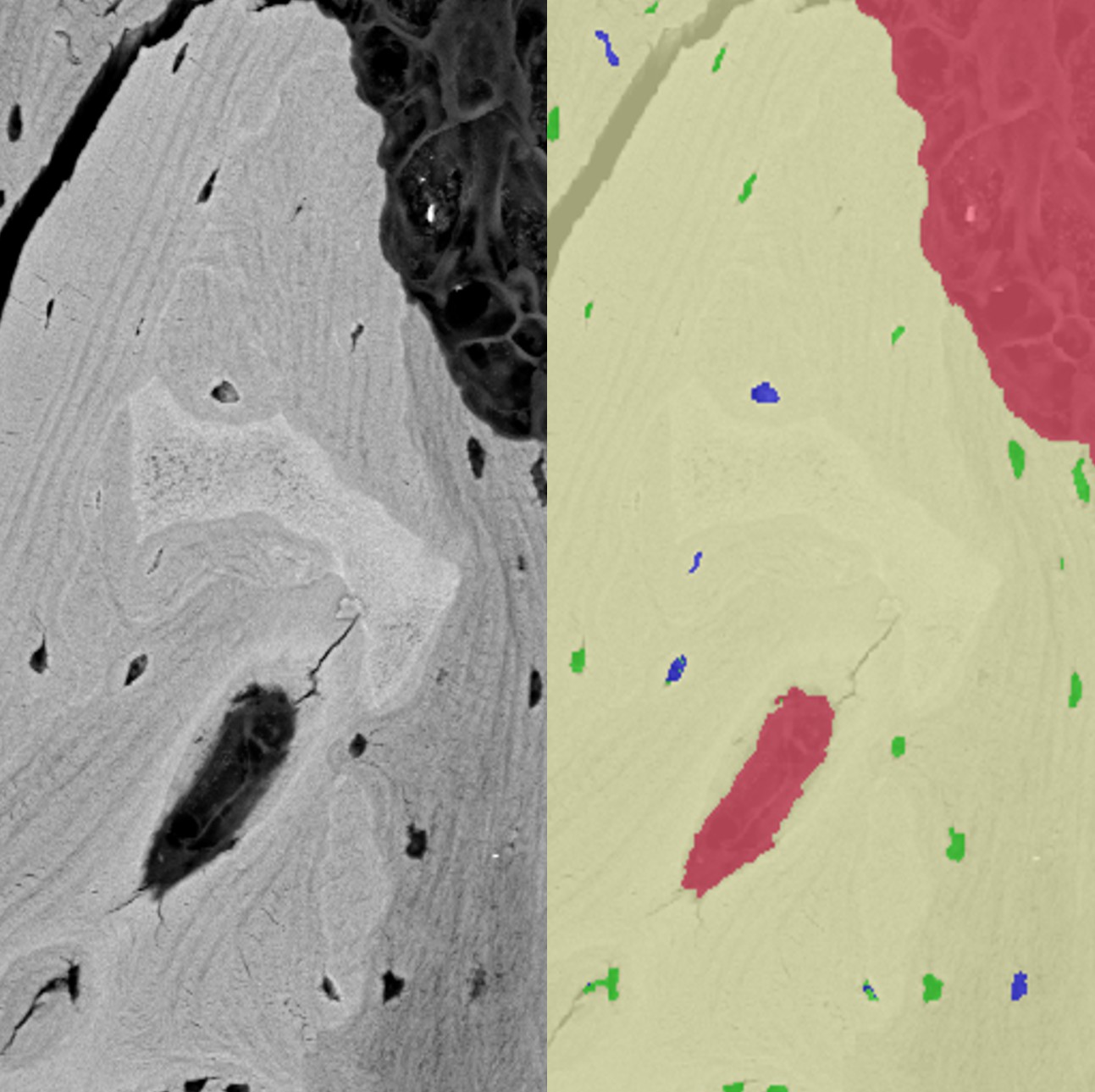 Deep Learning SEM Image Segmentation